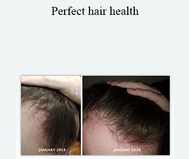Rob - Perfect hair health